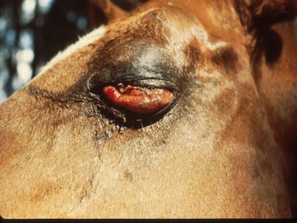 Edema tejido conjuntival 1