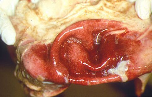 Hemorragias en mucosa de vejiga