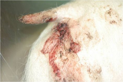 Melena o heces con sangre