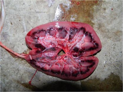 Hemorragias en la corteza renal