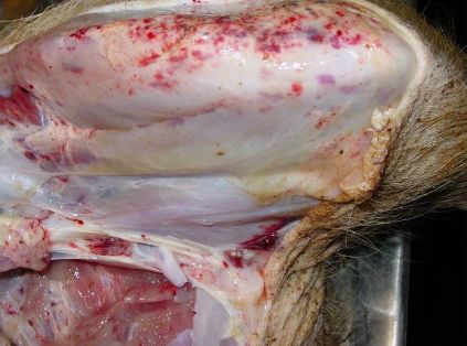 Hemorragias petequiales en piel y tejidos conectivos