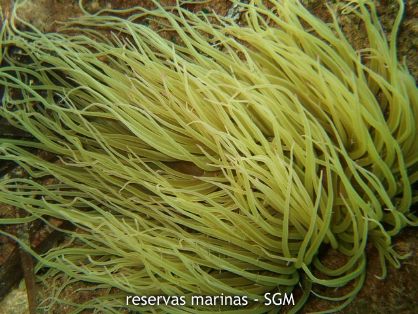 Autor: Felio Lozano Título: Anémona