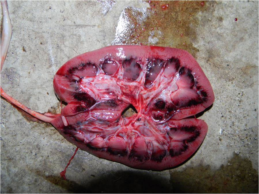 Hemorragias en la corteza renal